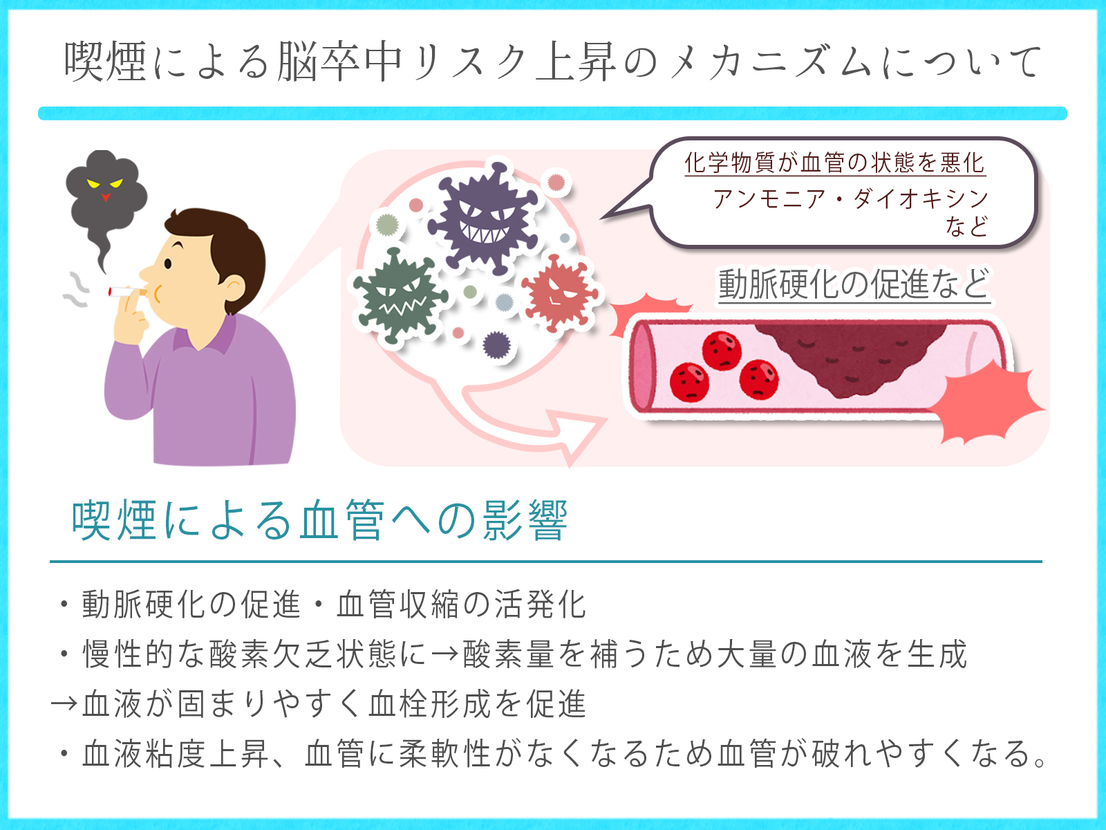 喫煙と脳卒中症状の関係 | 脳梗塞リハビリステーションPROGRESS 2023年3月6日