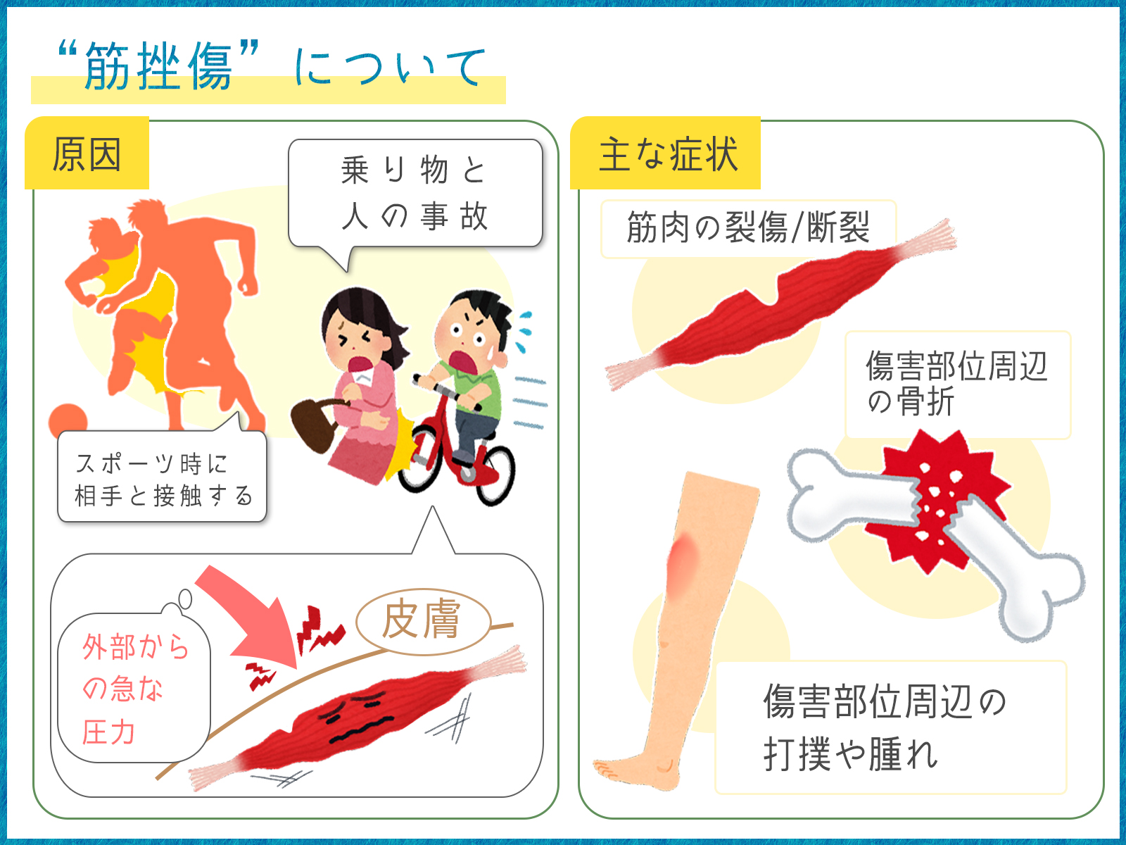 筋挫傷 肉離れについて 脳梗塞リハビリステーションprogress 22年10月17日