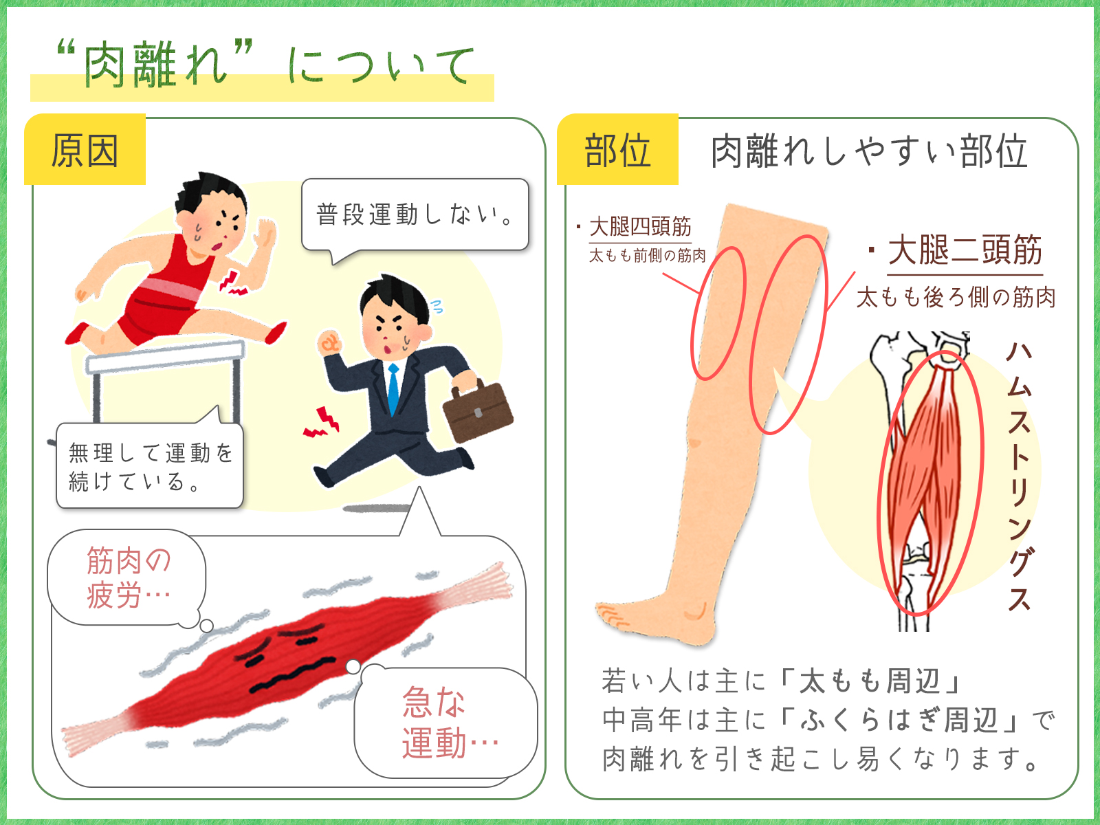 筋挫傷 肉離れについて 脳梗塞リハビリステーションprogress 22年10月17日